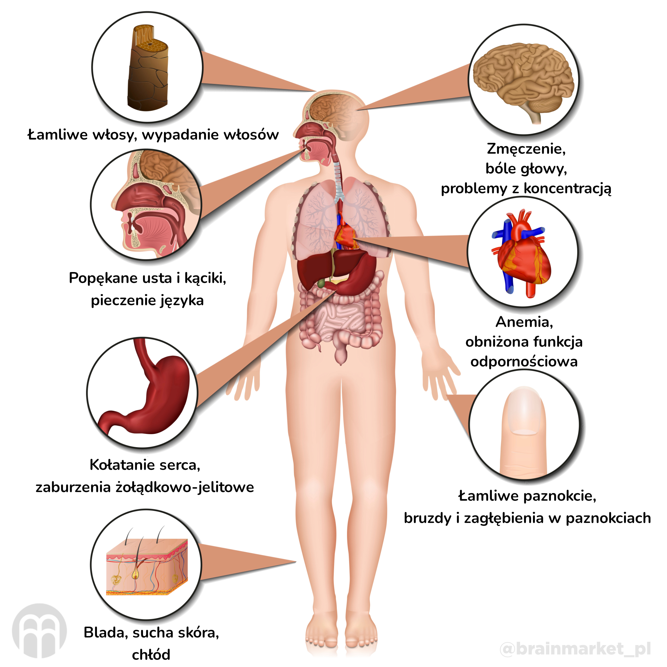 nedostatek zeleza_infografika_pl